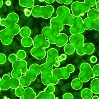 5 Ways to Keep Your Pool Algae Free During the August Heat
